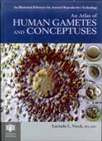Atlas of human gametes and conceptuses by Lucinda Veeck. Pathenon